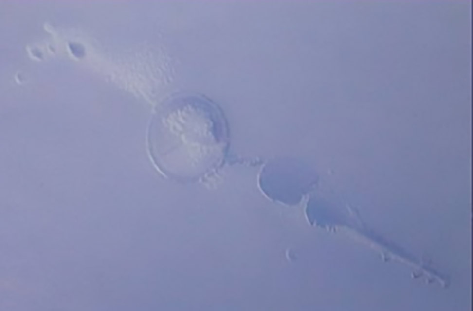 360-1-困气：注塑时带入空气